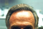 Male Hair example 1 after